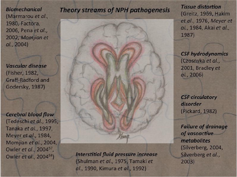 BODY SHIFT VALVE B40D