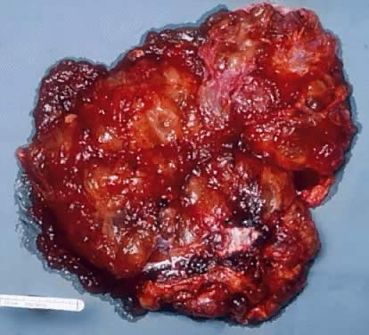 SHIM 1.6MM BIN SHOCK MAT B50 (BOTS)