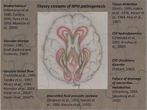 [AL200457] BODY SHIFT VALVE B40D