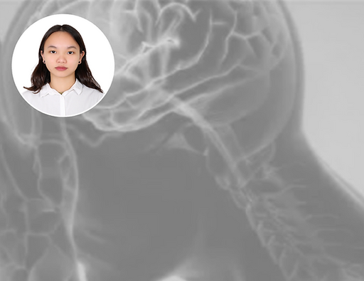 [AL200483] PLATE SEPARATOR